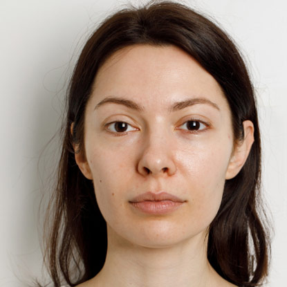 Skin Care & Anti Aging - Before