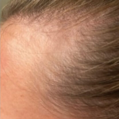 before-after-hair-2-a