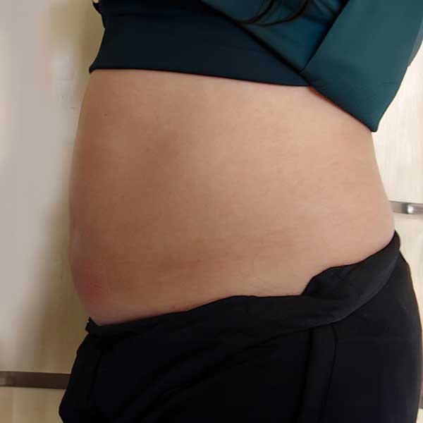before-afters-stomach-aftere