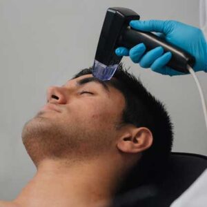 Who Choose Microneedling